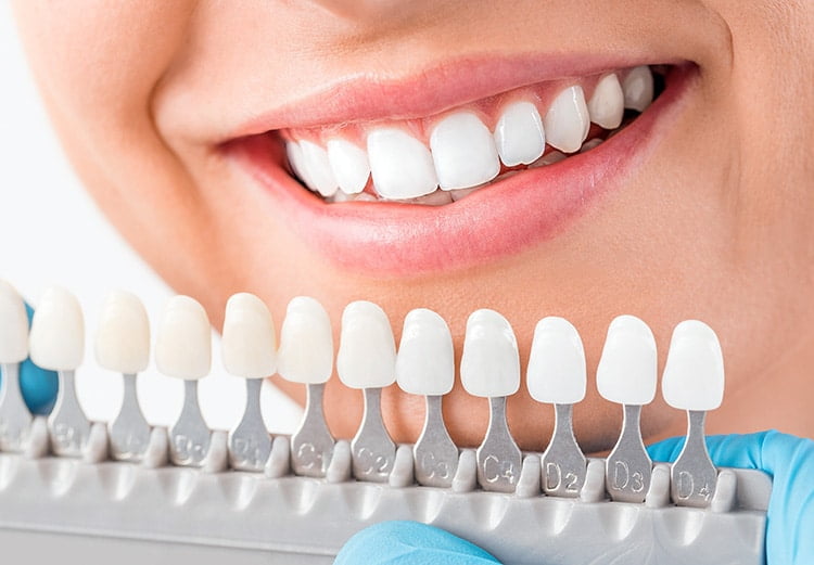Zirconia Restorations